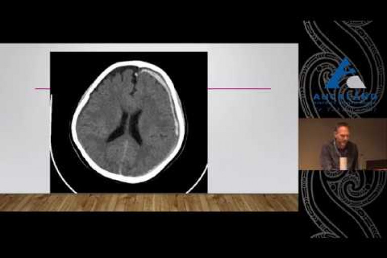 Major Trauma Case Review