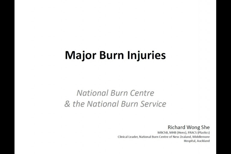 Major Burn Injuries