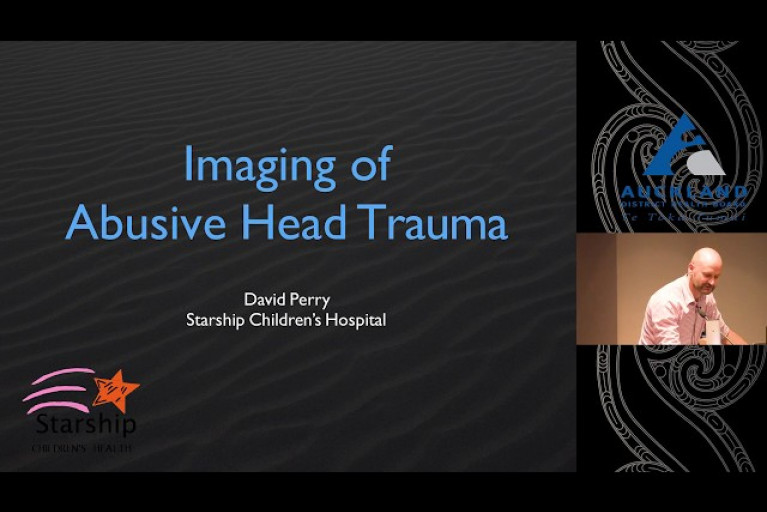 Abusive Head Trauma