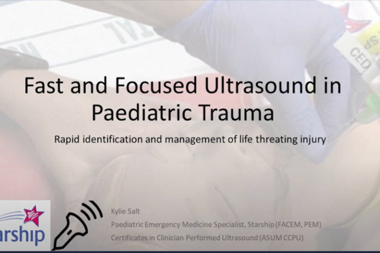 Fast and focused ultrasound in paediatric trauma