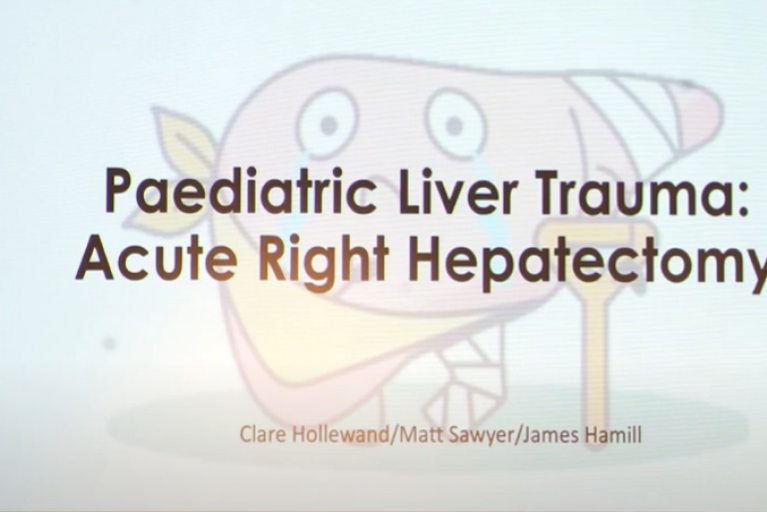 Paediatric liver trauma